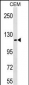 KIT Antibody (Y721)