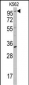 ROR2 Antibody