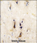 BACE1 Antibody (N-term)