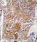 ALDH1L1 Antibody (C-term)