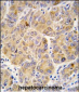 ALDH9A1 Antibody (C-term)
