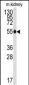 ALDH9A1 Antibody (C-term)