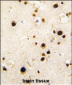 HNRPQ Antibody (C-term)