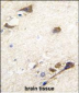 ACHE Antibody (N-term)