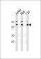 ACHE Antibody (N-term)