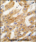 ALDH4A1 Antibody (C-term)