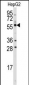 ALDH4A1 Antibody (C-term)