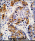 ALDH4A1 Antibody (Center)