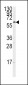 CYP17A1 Antibody (Center)