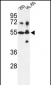 CYP21A2 Antibody (N-term)