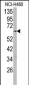 CYP2R1 Antibody (C-term)