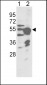 CYP2R1 Antibody (Center)