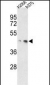 MEK1 Antibody (S218/222)