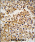 FARSB Antibody (N-term)