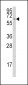 CYP1A1 Antibody (C-term)