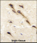 CYP26B1 Antibody (C-term)