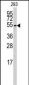 CYP26B1 Antibody (C-term)