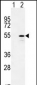 CYP26B1 Antibody (C-term)