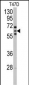 CYP2C8 Antibody (N-term)