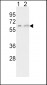 CYP7A1 Antibody (C-term)