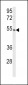 CYP8A1 Antibody (N-term)