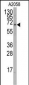 RORA Antibody (T216)