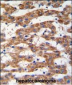 PHB Antibody (Center)
