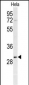 PHB Antibody (Center)