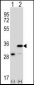 PHB Antibody (Center)