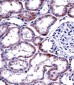 HNF4A Antibody (Center)