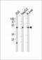 HNF4A Antibody (Center)