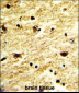 EXOSC8 Antibody (C-term)