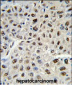 SSB Antibody (C-term)