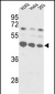 SSB Antibody (C-term)