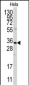 ANXA3 Antibody (N-term)