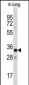 ANXA3 Antibody (Center)