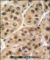 POLR1C Antibody (C-term)