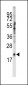 SNRPC Antibody (C-term)