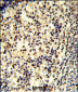 SNRPD1 Antibody (C-term)