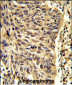 SNRPD1 Antibody (Center)