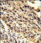 TRIP13 Antibody (N-term)