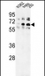 TRIP13 Antibody (N-term)