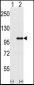 INPP5D Antibody (Center)