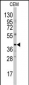 CCNB2 Antibody (Center)