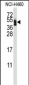 CXADR Antibody (Center)