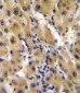 ENPP2 Antibody (Center K416)