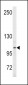 ENPP2 Antibody (Center K416)