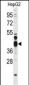 FEN1 Antibody (Center)