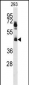 HNRPK Antibody (N-term)