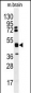 HNRPK Antibody (N-term)